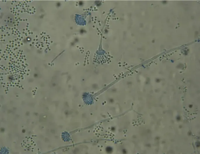 カビの顕微鏡写真